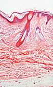 Human skin section,light micrograph