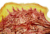 Skin layers,light micrograph