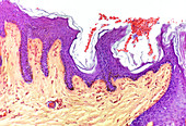 Skin layers,light micrograph