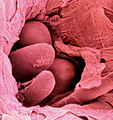 False col. SEM of human scalp,new hair emerging