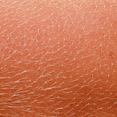 Close-up of hairs on the skin of a woman