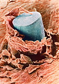 Coloured SEM of a shaved hair in the skin