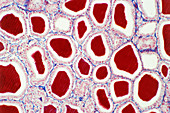 Light micrograph of the human thyroid gland