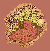 Endocrine cell,TEM