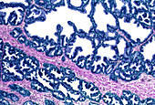 Prostate gland,light micrograph