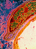 Fibroblast cell,coloured TEM