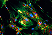 Immunofluorescent LM of skin fibroblast cells