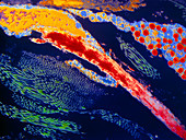 Coloured TEM of elastin,fibroblast and collagen
