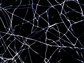Artwork of elastin fibre network in human skin
