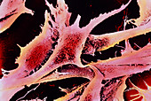 Coloured SEM of cultured fibroblast cells