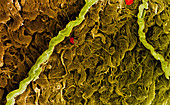 SEM of collagen connective tissue fibres