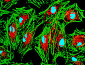 Coloured TEM of mammalian fibroblast cells