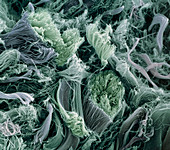 Collagen fibres,SEM