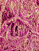 Collagen fibres,SEM