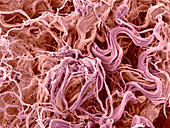 Collagen fibres,SEM