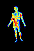 Thermogram