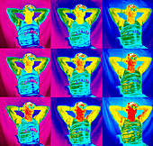Thermograms of a man sunbathing