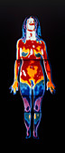 Thermogram of a woman