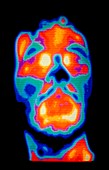 Thermogram of a man's face