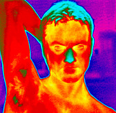 Thermogram of a man's head and shoulders