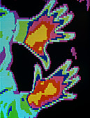 Thermogram of a cold pair of hands