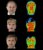 Head thermograms