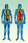 Whole-body scintigram of a healthy man