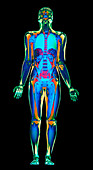 MRI body scan