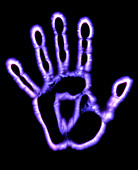 Kirlian photograph of a human hand