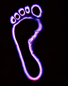 Kirlian photograph of a human foot