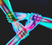 Coloured X-ray of a triangle of three linked hands