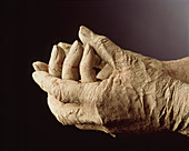 Mud-covered hands