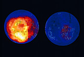Gamma Ray Spectrometer map of thorium on the Moon