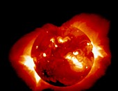 X-ray image of solar corona