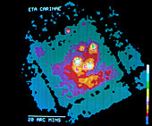 X-ray image of the Carina Nebula