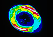 Optical CCD image of the Ring Nebula M57