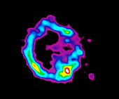 Supernova remnant in X-rays