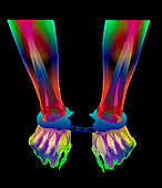 Coloured X-ray of a person's wrists in handcuffs