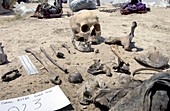 Human remains at a mass grave,Iraq,2003