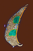 Giardia protozoan,TEM