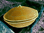 Dinoflagellate,SEM
