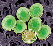 Calcareous phytoplankton plates,SEM