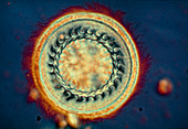 Trichodina parasite