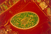 Light micrograph of Paramecium bursaris