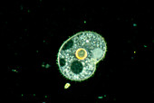 Light micrograph of a ciliate protozoan