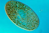 Frontonia ciliate protozoan