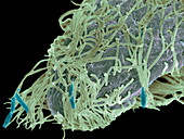 Alga-covered protozoan,SEM