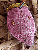 Ciliate protozoan,SEM