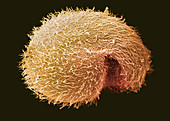Breslauides ciliate protozoan,SEM