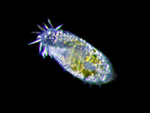 Ciliate protozoan,light micrograph